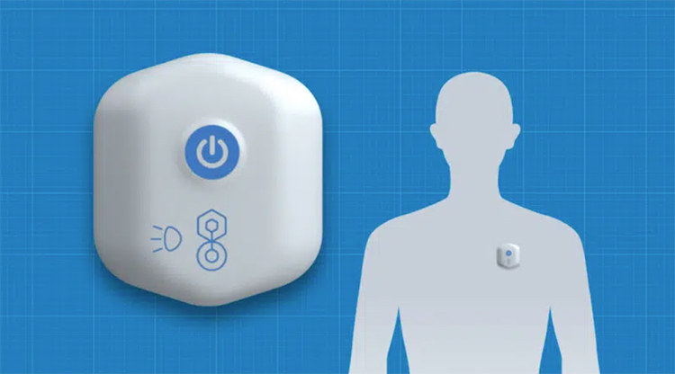 BioIntelliSense推出医疗用可穿戴设备 能检测20多种生命特征