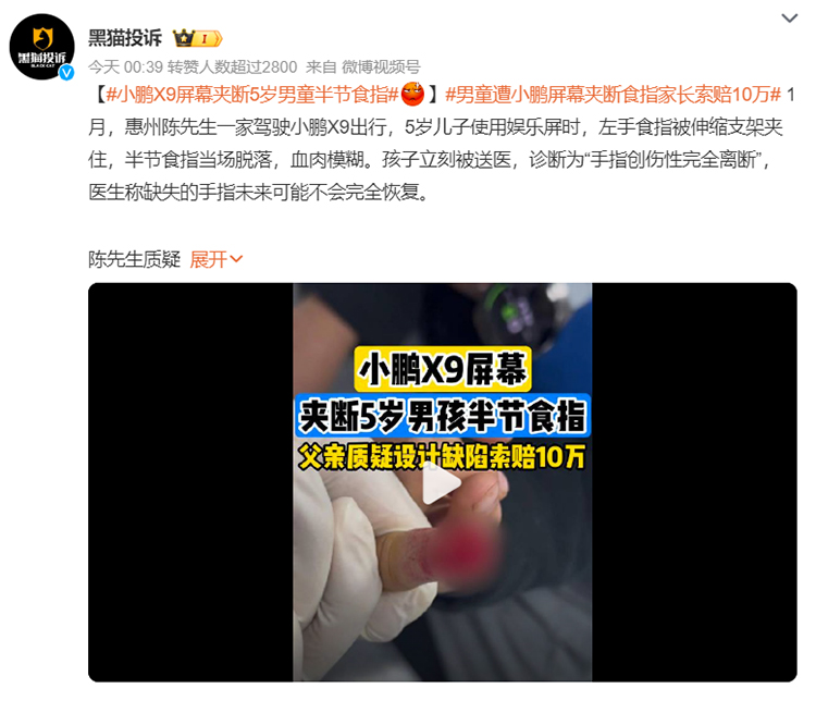 X9屏幕夹断儿童食指！小鹏汽车回应：将排查升级防夹功能