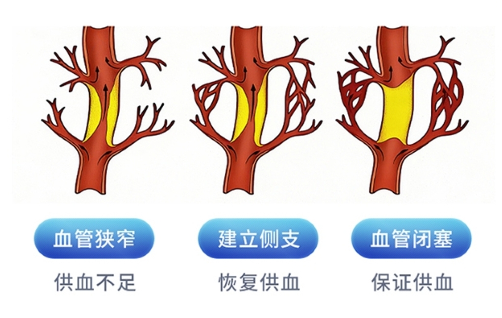 每天25分钟，爱奥乐缺血预适应训练仪帮你稳血压、呵护心...